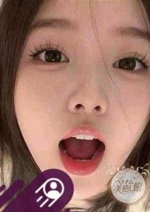 ゆみ